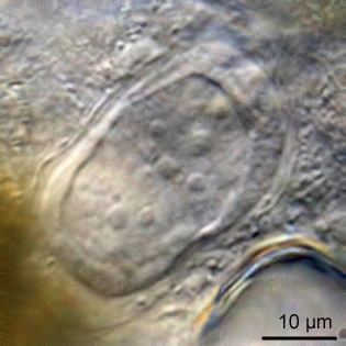 Thecamoeba terricola