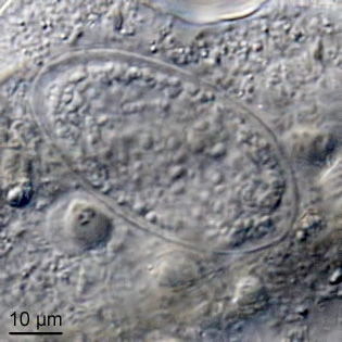 Thecamoeba terricola