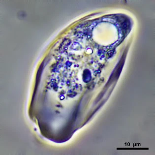 Thecamoeba quadrilineata