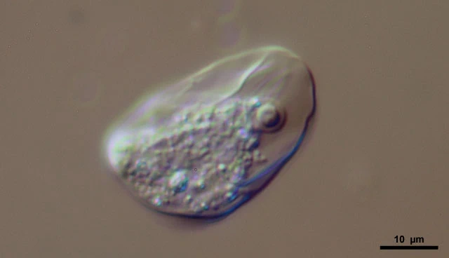 Thecamoeba quadrilineata