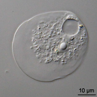 Thecamoeba quadrilineata