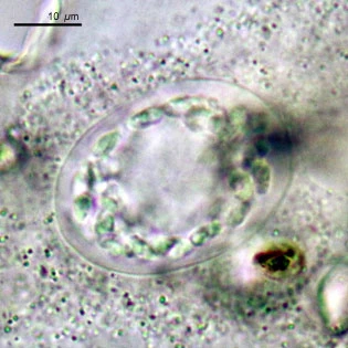 Thecamoeba terricola