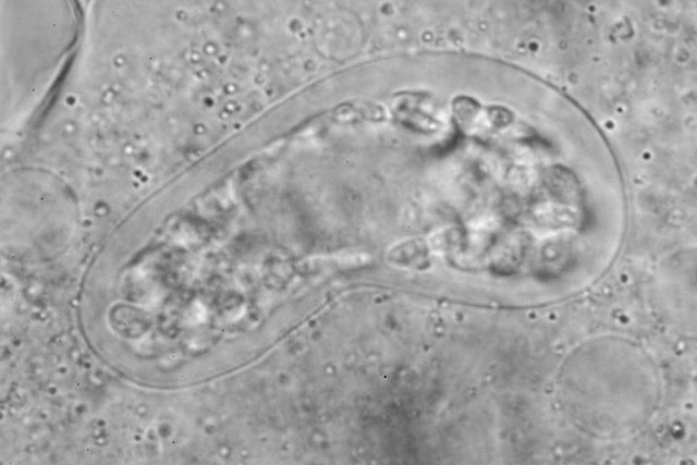 Thecamoeba terricola