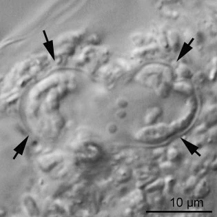 Thecamoeba terricola