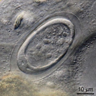 Thecamoeba terricola