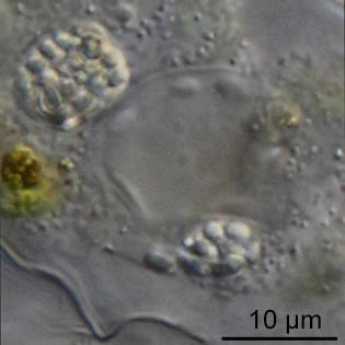 Thecamoeba terricola