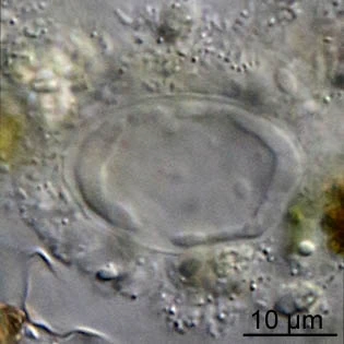 Thecamoeba terricola