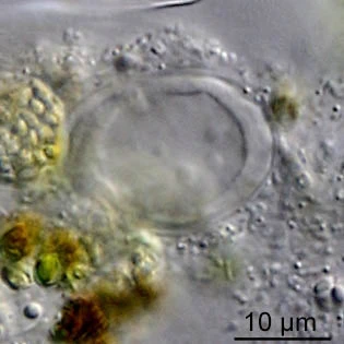 Thecamoeba terricola