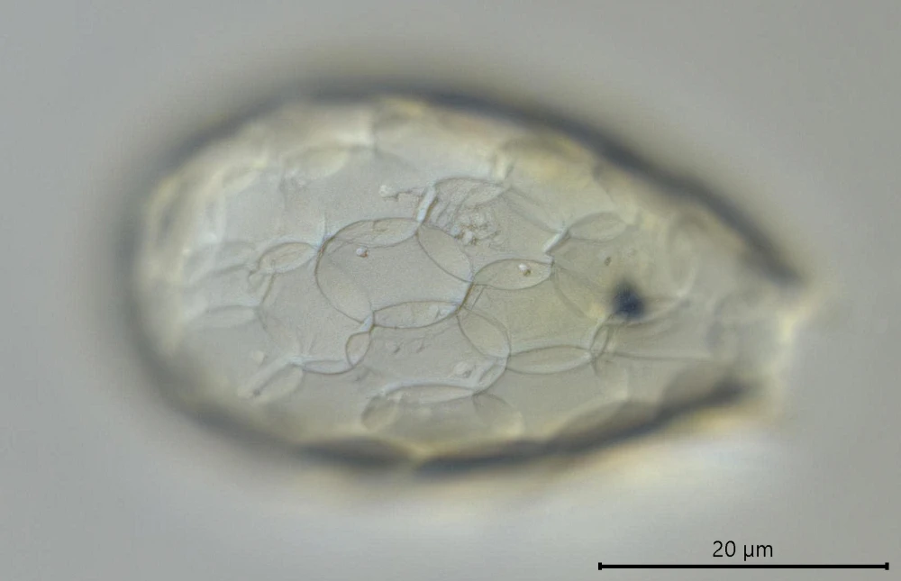 Tracheleuglypha acolla