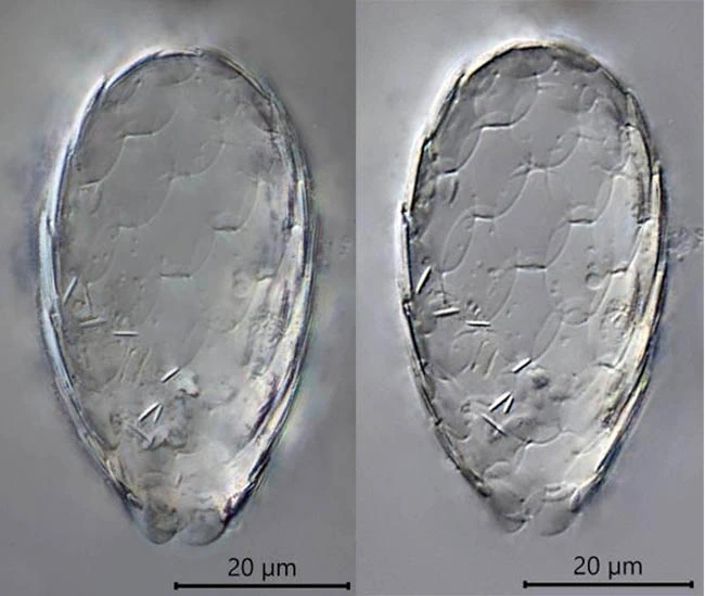 Tracheleuglypha acolla