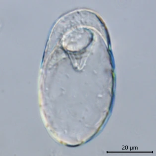 Trinema galeata