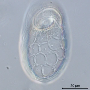 Trinema galeata