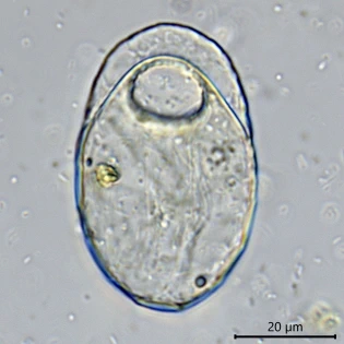 Trinema galeata