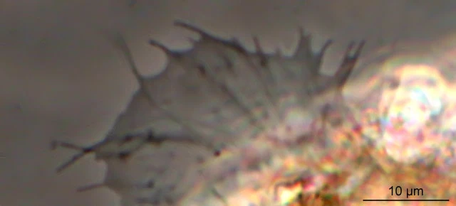Rhogostoma