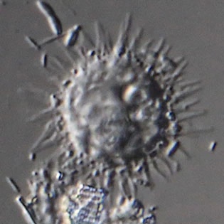 Belonocystis spec.