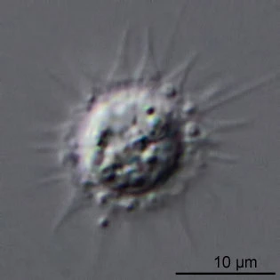 Belonocystis spec.