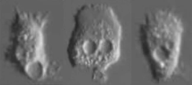 Vacuolamoeba acanthoformis