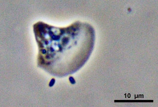 Vannella preying on bacteria