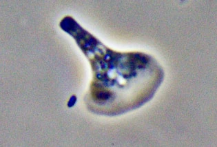 Vannella preying on bacteria