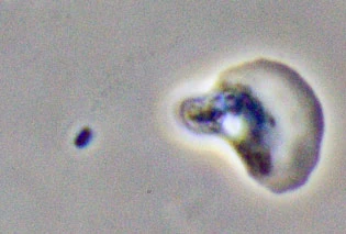 Vannella preying on bacteria