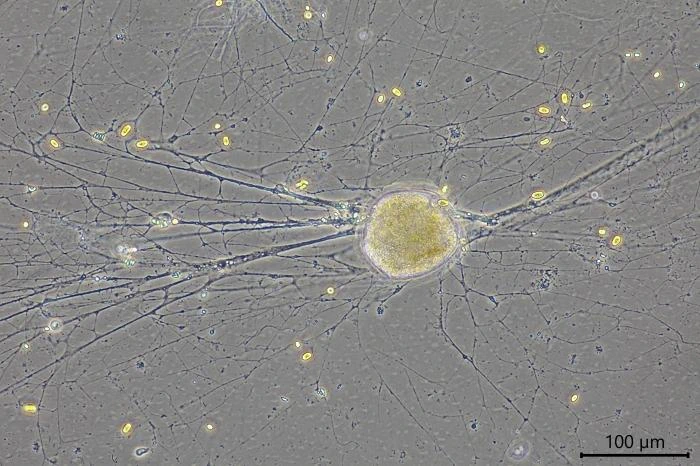 Velamentofex dujardini