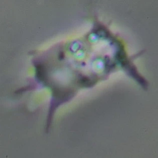 Vexillifera bacillipedes