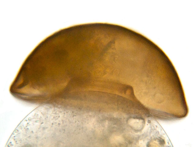 Arcella crenulata