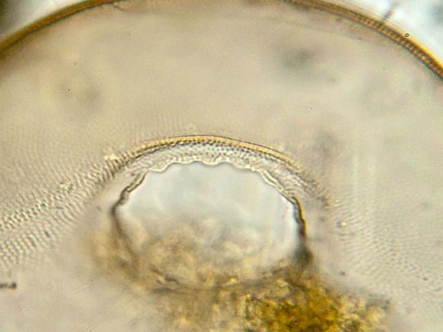Arcella crenulata