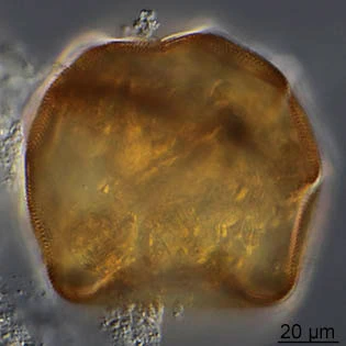 Arcella spectabilis