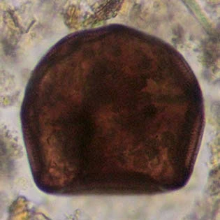 Arcella spectabilis