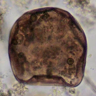 Arcella spectabilis