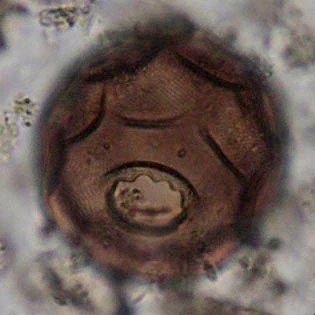 Arcella spectabilis