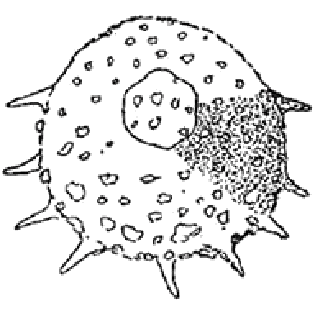 Centropyxis aculeata