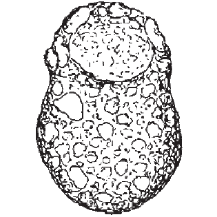 Centropyxis platystoma