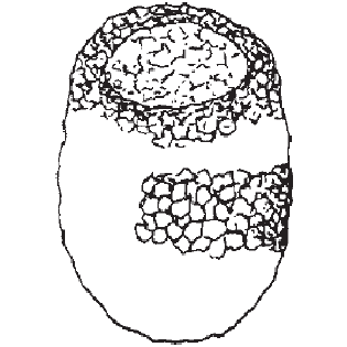 Centropyxis marsupiformis