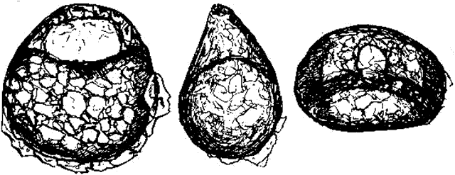 Centropyxis sylvatica