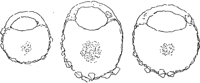 Centropyxis sylvatica
