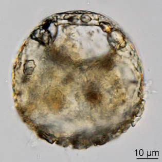 Centropyxis sylvatica