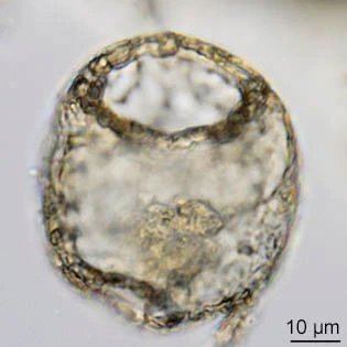 Centropyxis sylvatica