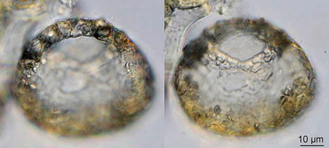 Centropyxis sylvatica