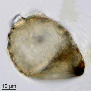 Centropyxis sylvatica