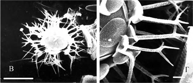 Choanocystis malyutini