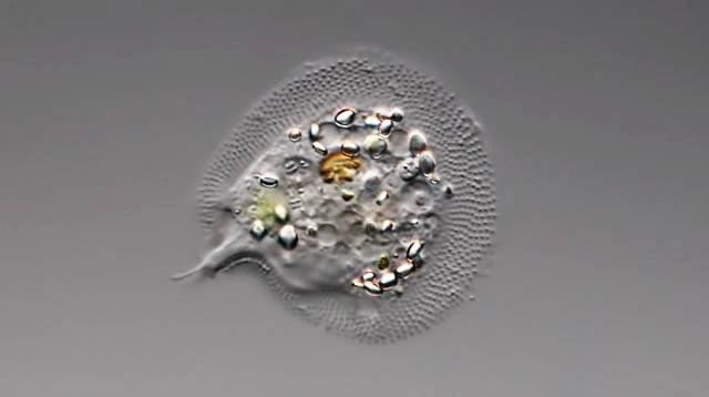 Cochliopodium bilimbosum