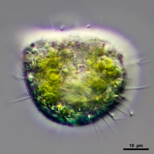 Cochliopodium cf vestitum