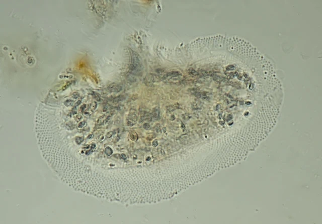 Cochliopodium bilimbosum