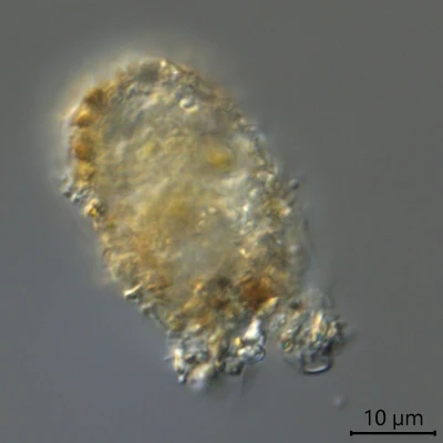 Pseudodifflugia spec.