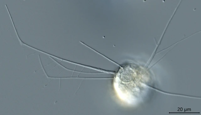 Pseudodifflugia spec.