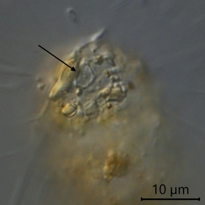 Pseudodifflugia spec.