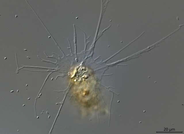 Pseudodifflugia spec.