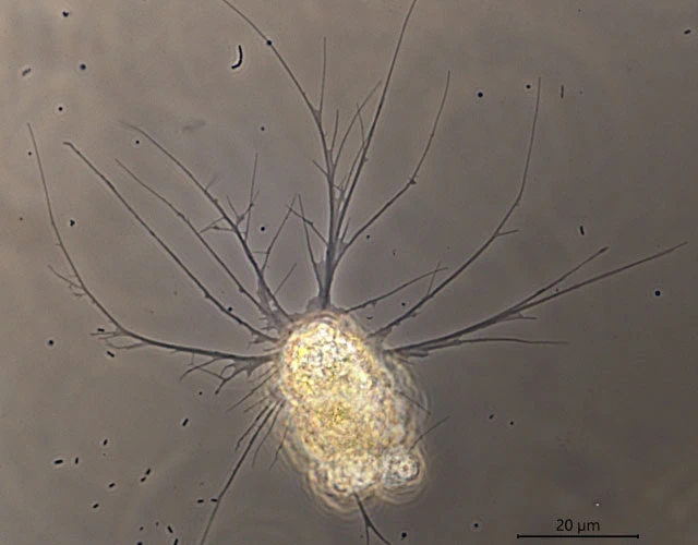 Pseudodifflugia spec.